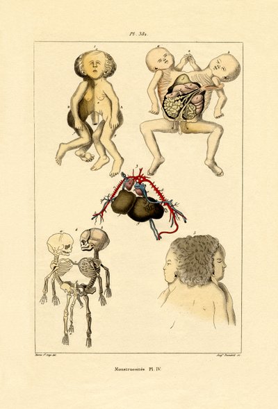 Freak, 1833-39 alkotó: French School